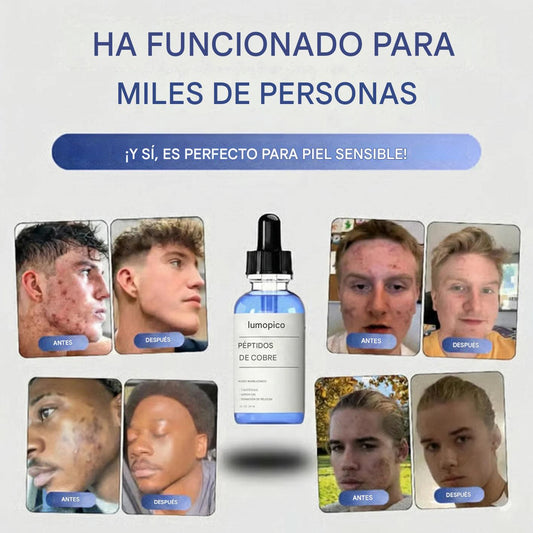 Sérum de Péptidos Reafirmante – Piel Joven y Luminosa